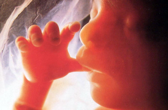 Suprema Corte debatirá este miércoles 29 el “derecho” al aborto – dile tu opinión