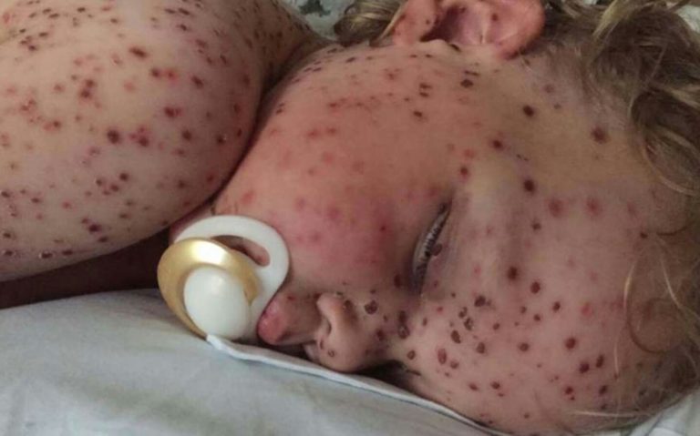 Páginas de FB usan fotos de niños enfermos para estafarte