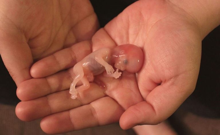 Aborto o no aborto, he ahí el dilema