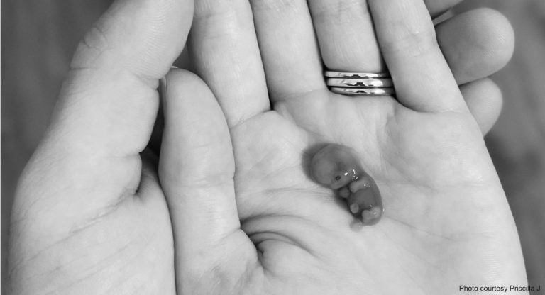 Una madre comparte fotos de su bebé abortado a las 9 semanas para mostrar la creatividad y la maravilla de Dios
